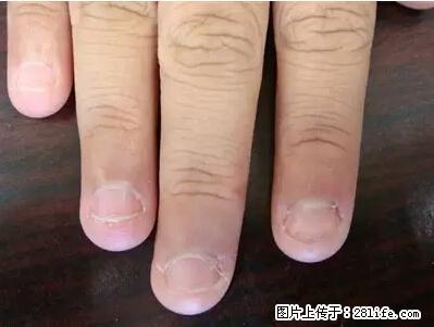 剪指甲、挖耳屎，这些日常小动作竟隐藏大危害！ - 正定生活资讯 - 正定28生活网 zd.28life.net